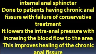 Surgical operations internal anal sphinctrotomy