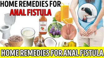 ✅ Anal fistula || anal fistula treatment || home remedies for anal fistula