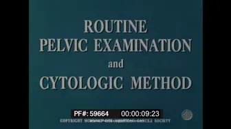 1958 MEDICAL TRAINING FILM ROUTINE PELVIC EXAMINATION CYTOLOGIC METHOD PAP TEST 59664