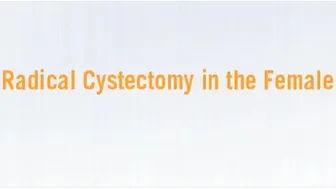 Radical Cystectomy in Female |Step by Step Procedure |Urology |