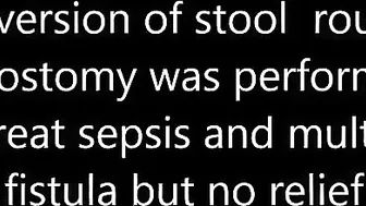 Role of Colostomy in anal Fistula Dr Ashish Bhanot #3