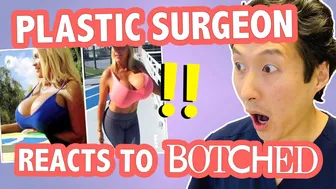 The Largest Breast Implants Ever? Plastic Surgeon Reacts to BOTCHED