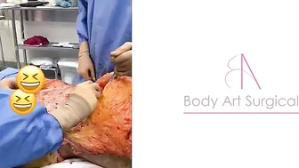 Body Art Surgical / Tummy Tuck #2