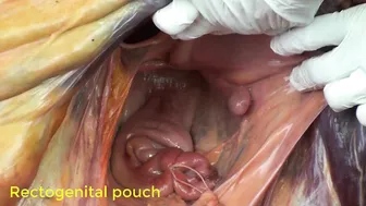 Anatomy of the equine male reproductive system #4